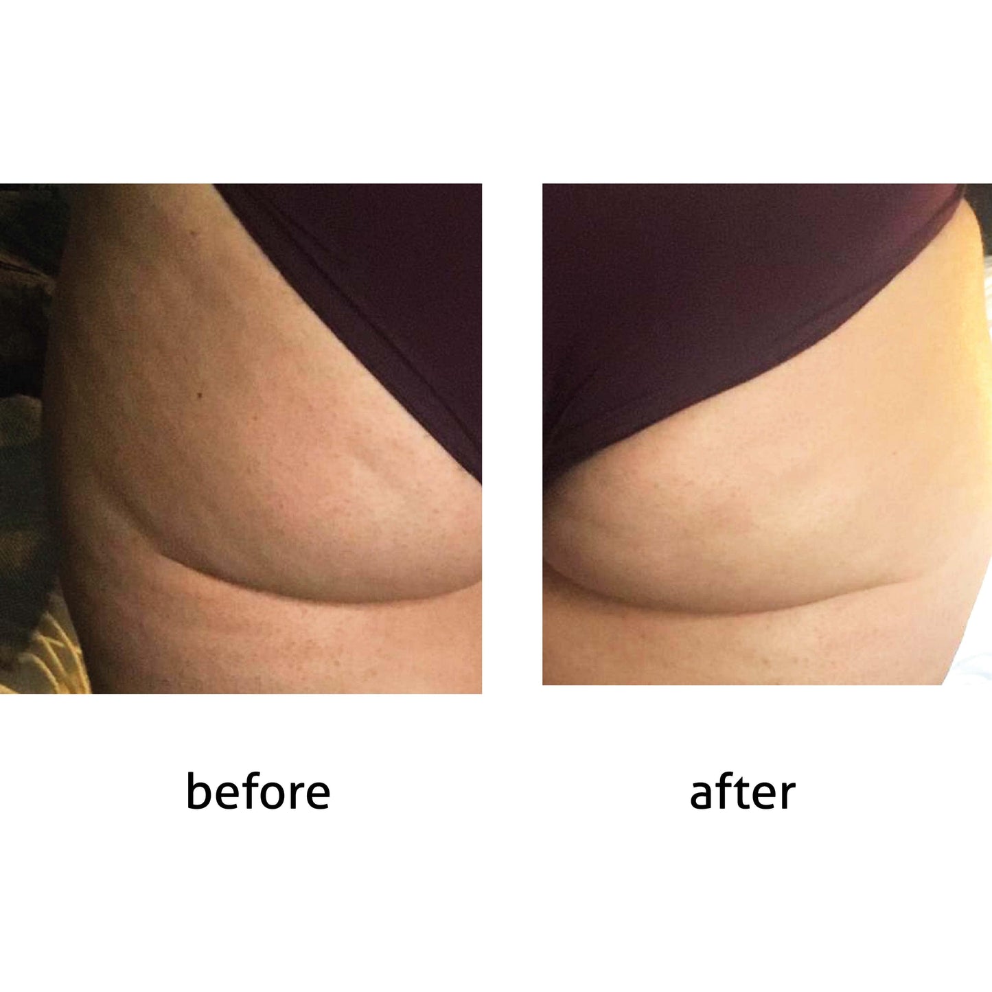 MotherSage MotherSage Anti-Cellulite & Slimming Gel