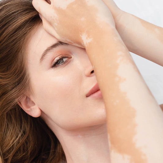 Dry Skin: Causes, Treatments & Prevention Tips